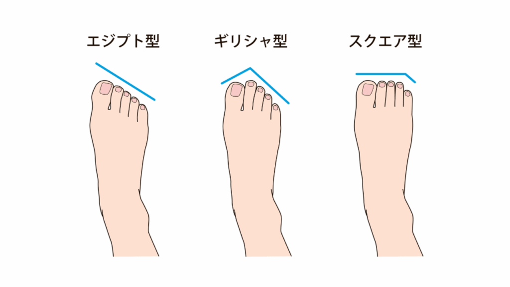 足のタイプ